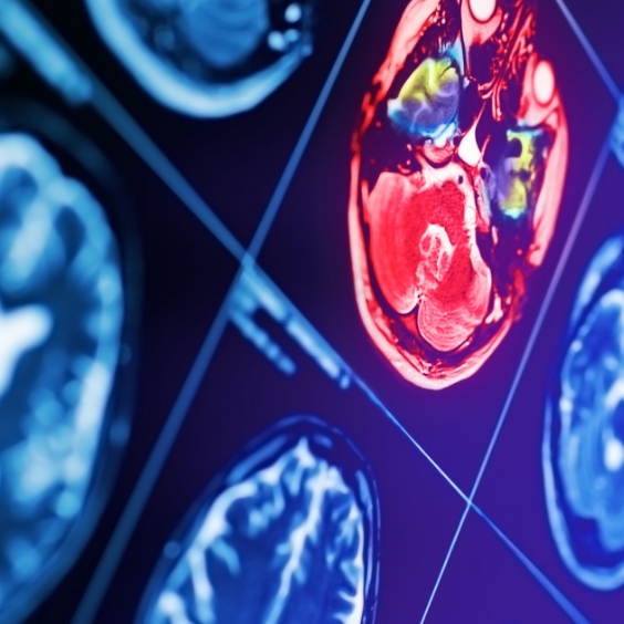 Featured image for “Oncology”